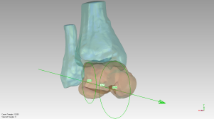 Artificial Ankle Model